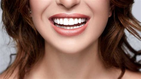 Top 10 Celebrity Smiles Of All Time Dental Image