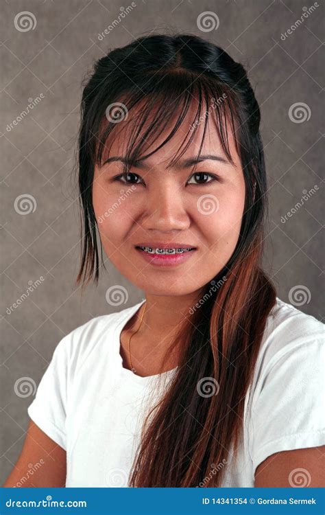 Thai Girl With Braces Stock Photo Image Of Emotion Expression