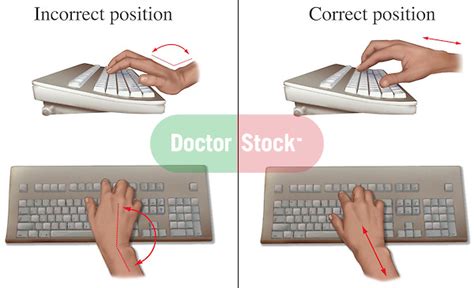 Carpal Tunnel Prevention Ergonomic Hand Position At Keyboard Doctor