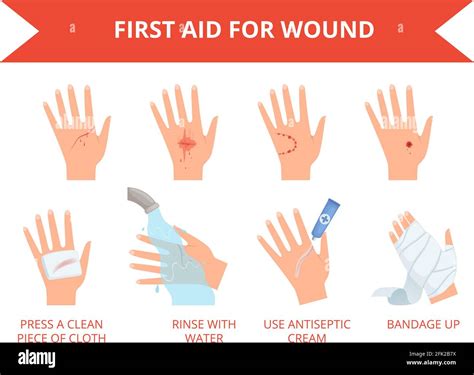 Wound Skin Treatment First Emergency Help For Human Hand Trauma