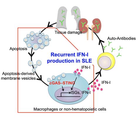 Pathophysiology Of Systemic Lupus Erythematosus