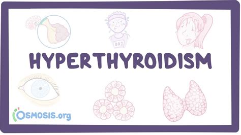 Hyperthyroidism Causes Symptoms Diagnosis Treatment Pathology