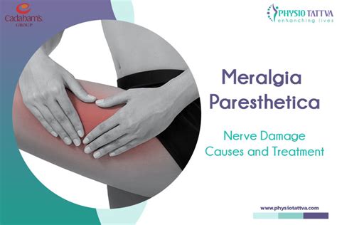 Meralgia Paresthetica Symptoms Causes And Treatment
