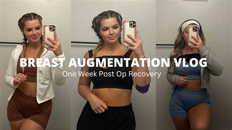 Breast Augmentation Vlog My One Week Post Op Experience Regrets How