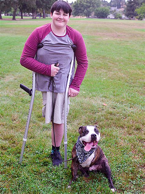 A Young Cancer Survivor And Amputee Finds A Bff In A 3 Legged Rescue Dog