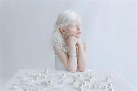 Albinism Photographs Yulia Taits Part 2 Popsugar Beauty