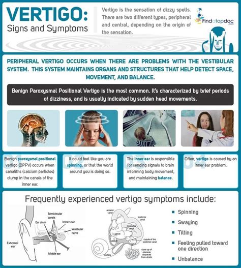 What Is Vertigo Facts About Vertigo Infographic