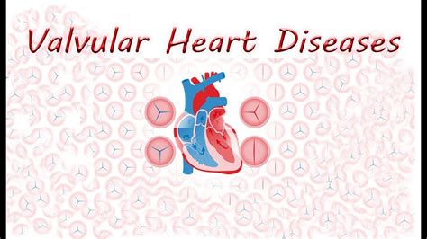 Valvular Heart Diseases 1 The Effect Of Maneuvers On Murmurs With
