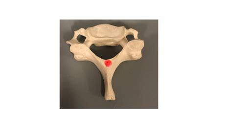 Cervical Vertebrae Diagram Quizlet