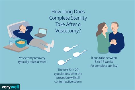 Sex After A Vasectomy Healing And Effectiveness
