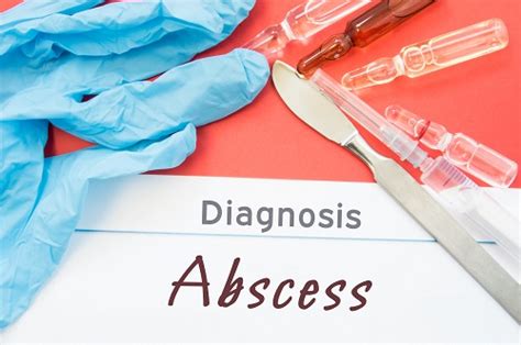 Smaller Skin Abscess Healing Rates May Be Improved With Course Of