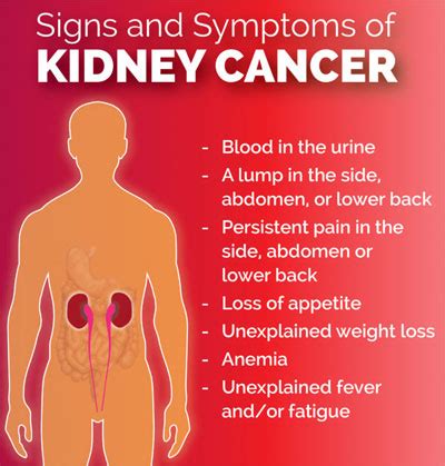 Learn about kidney cancer (renal cell cancer) signs and symptoms, including include blood in the urine, pain, fever and weight loss. Renal Cell Carcinoma - Benefits of taking Organic Fagonia ...