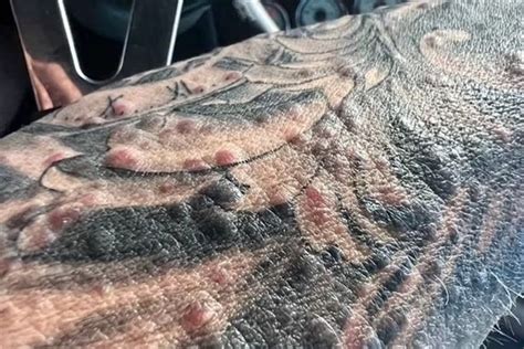 Top 164 Bumps On Old Tattoo