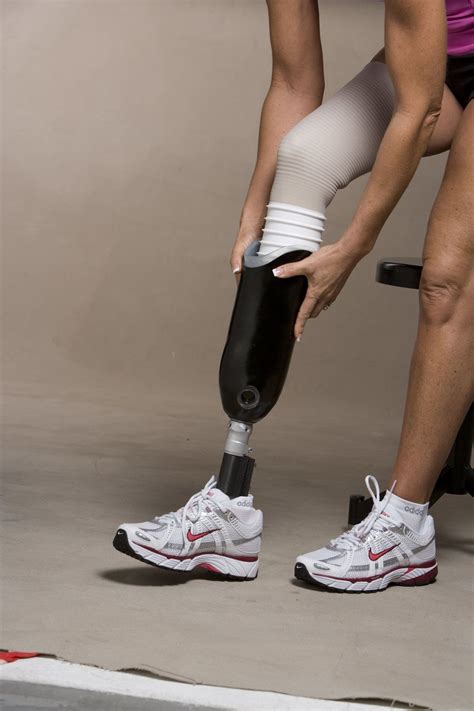 Artificial Leg Fitting Below The Knee Amputation Leg Prosthesis