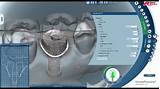 Images of Best Dental Lab Software