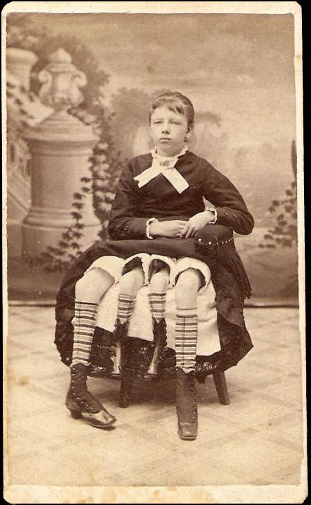 Josephine Myrtle Corbin Was Born In 1868 With A Reality Is