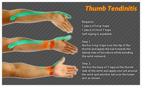 Ares Clinical Taping Rheumatism Thumb Tendinitis Kt Tape Wrist Pain