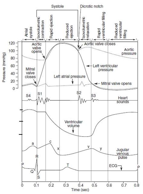 Drag The Labels Onto The Wiggers Diagram To Identify Specific Events