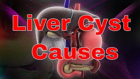 Causes Of Liver Cysts Youtube