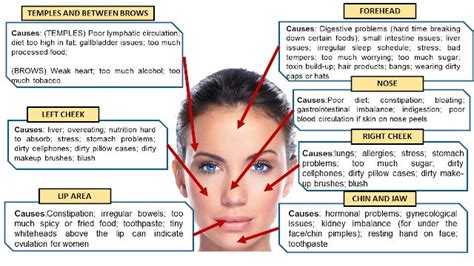 Facts About The Location Of Your Acne That You Probably Teenage