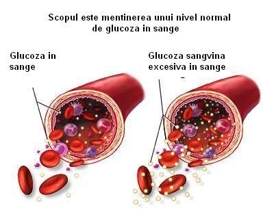 Diabet și boli de nutriție Clinica Expert Medical Focsani Vrancea