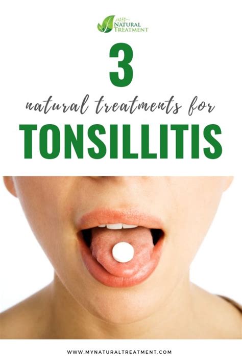 3 Natural Treatments For Tonsillitis With Lemons Tonsilitis Remedy