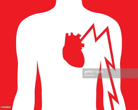 Hearts Attack Left Arm Pain High Res Vector Graphic Getty Images