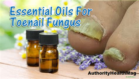 It is used alongside prescribed medical antifungal treatments. Essential Oils For Toenail Fungus | 7 Antifungal Remedies