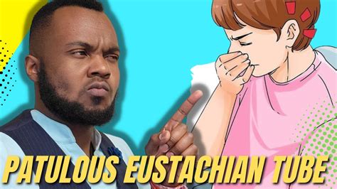 How To Heal Patulous Eustachian Tube Dysfunction Youtube