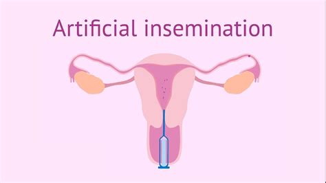 Artificial Insemination Youtube