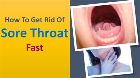 How To Get Rid Of Sore Throat Fast Top 5 Tricks To Remove Sore Throat