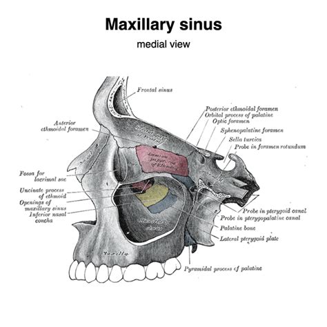 Maxilla Pacs