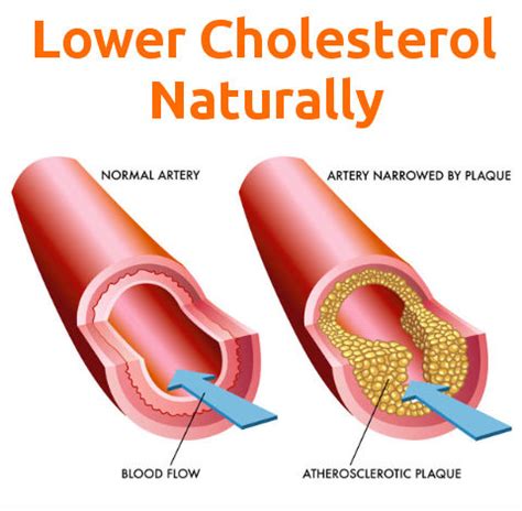 They are bigger and denser. Lower Cholesterol Naturally - Cholesterol Lowering Foods ...