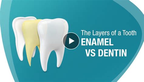 Stained Teeth Or Enamel Erosion How To Tell The Difference