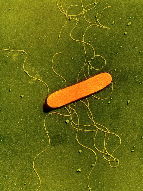 Listeria Monocytogenes Bacterium Photograph By A Dowsett Public