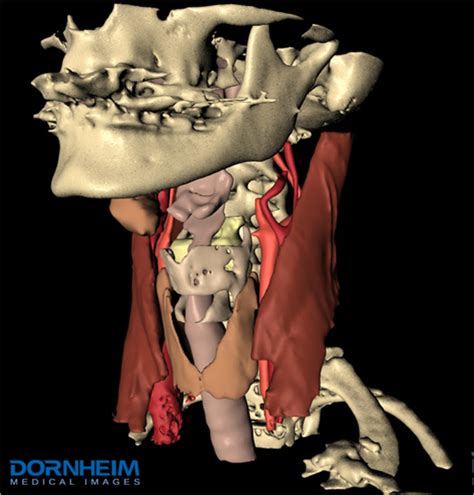 Each arm is attached to a shoulder blade. A 3D model of the neck anatomy with bones, muscles, blood ...