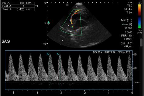 Neonatal Head Ultrasound Wisdom In Diagnostic Imaging College Of