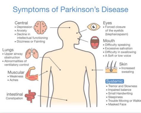 Parkinsons Disease Stages Death