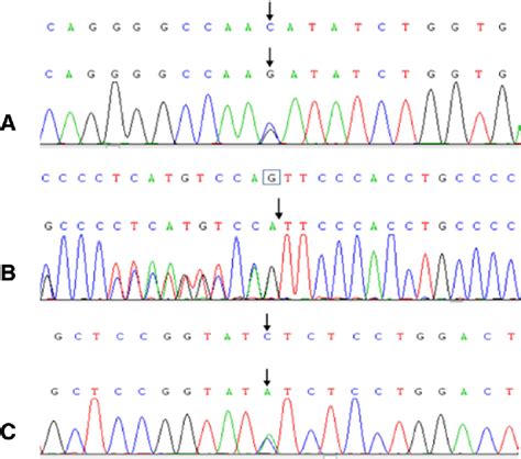 Sanger Sequencing Of Candidate Variants A A Paternally Inherited Download Scientific Diagram