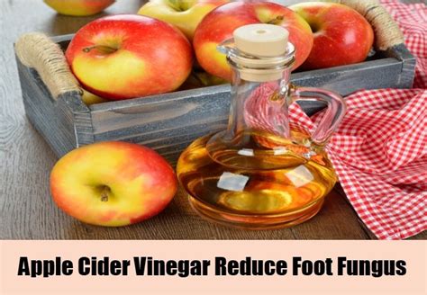 Vinegar Toenail Fungus Treatment Listerine Foot Soak