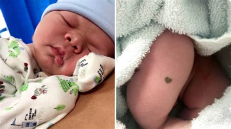 Baby Born With Adorable Heart Shaped Birthmark On His Leg Metro News