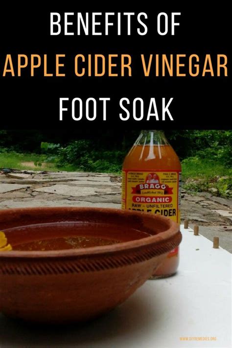 30 Health Applications For Apple Cider Vinegar You Did Not Know Apple