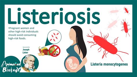 Listeriosis Listeria Monocytogenes Sources Pathophysiology