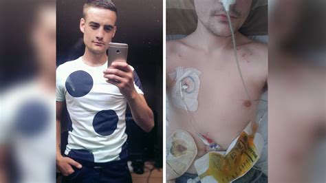 Man With Crohns Disease Shares Photo To Raise Awareness Of Unseen