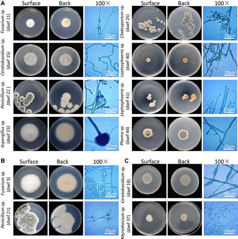 Morphological Characteristics Of Endophyte Fungi Photographs Showing