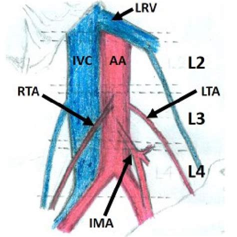 Schematic Diagram Showing The Normal Right And Left Testicular Artery