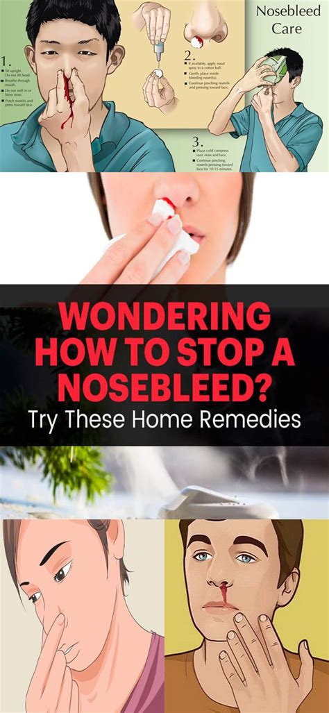 How To Stop A Nosebleed 4 Home Remedies Health Home Remedies Remedies