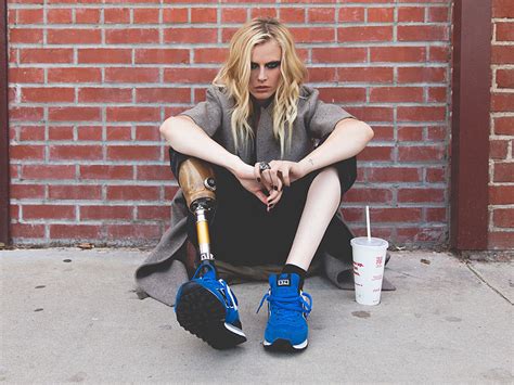 This Model Lost Her Leg To Toxic Shock Syndrome And Is Now Walking At