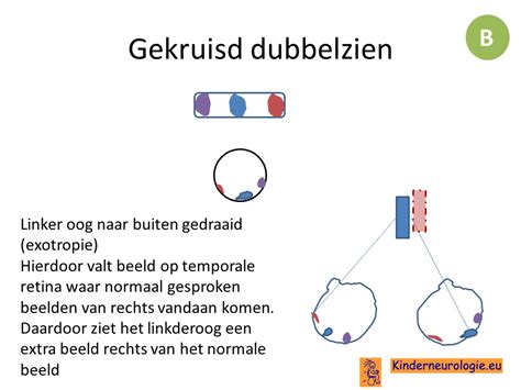 Kinderneurologie Eu