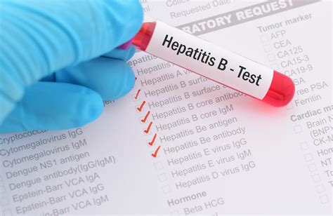 Hepatitis b is a serious liver infection caused by the hepatitis b virus (hbv). Hepatitis B | aidsmap